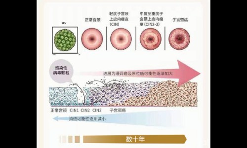 保妇康栓对宫颈炎效果好吗-保妇康治疗宫颈炎效果如何网- 保妇康栓治宫颈炎几粒一疗程知识,分享保妇康是治炎症的吗